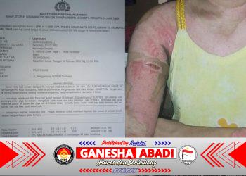 LP Jalan di Tempat, Keluarga Korban Desak Polisi Bertindak